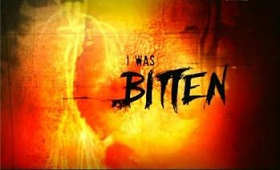 i-was-bitten